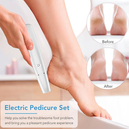 Electric Foot Callus Remover