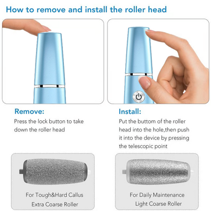 Electric Foot Callus Remover