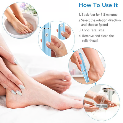 Electric Foot Callus Remover