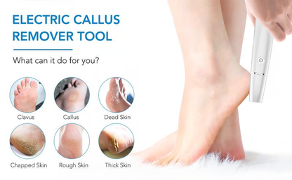 Electric Foot Callus Remover