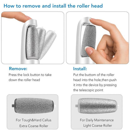 Foot Callus Smoother