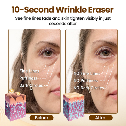 Fast-Acting Wrinkle Serum