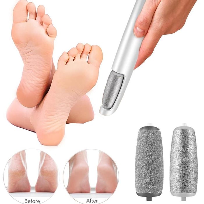Foot Callus Smoother