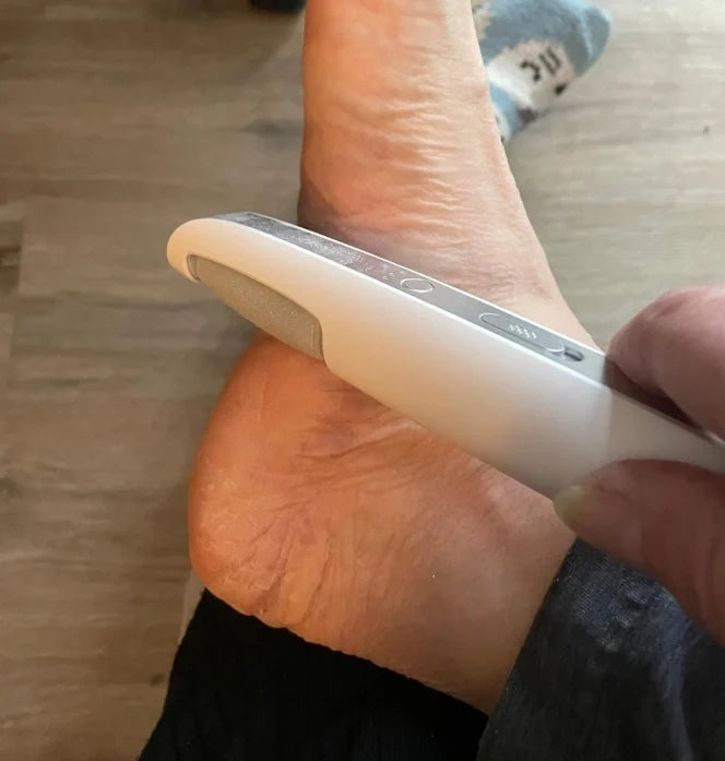 Electric Foot Callus Remover