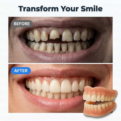Adhesive-Free Fit Denture Set