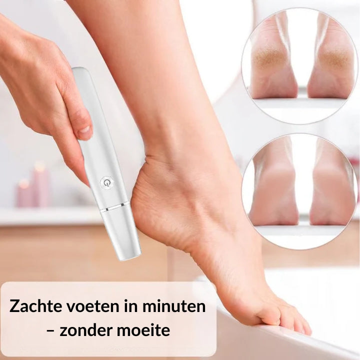 Foot Callus Smoother
