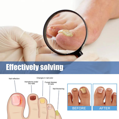 Nail Renewal Patches, 60 Count